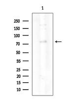 Phospho-PKC delta (Ser645) Antibody in Western Blot (WB)