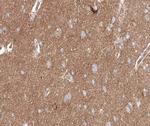 Phospho-PKC delta (Ser645) Antibody in Immunohistochemistry (Paraffin) (IHC (P))