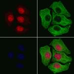 Phospho-IkappaB beta (Ser19) Antibody in Immunocytochemistry (ICC/IF)