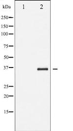 Phospho-IkappaB beta (Ser19) Antibody in Western Blot (WB)