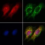 PIK3CA Antibody in Immunocytochemistry (ICC/IF)