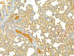 PIK3CA Antibody in Immunohistochemistry (Paraffin) (IHC (P))