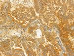 PIK3CA Antibody in Immunohistochemistry (Paraffin) (IHC (P))