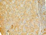 PIK3CA Antibody in Immunohistochemistry (Paraffin) (IHC (P))