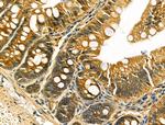 IL-5 Antibody in Immunohistochemistry (Paraffin) (IHC (P))