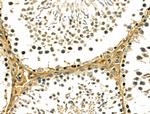 IL-5 Antibody in Immunohistochemistry (Paraffin) (IHC (P))