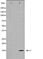 IL-5 Antibody in Western Blot (WB)