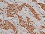 BMP-3 Antibody in Immunohistochemistry (Paraffin) (IHC (P))