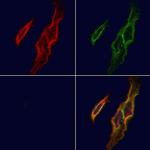 CD103 Antibody in Immunocytochemistry (ICC/IF)