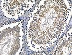 CD103 Antibody in Immunohistochemistry (Paraffin) (IHC (P))