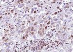 SMAD6 Antibody in Immunohistochemistry (Paraffin) (IHC (P))