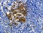 Cathepsin G Antibody in Immunohistochemistry (Paraffin) (IHC (P))