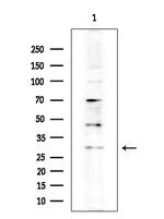 Cathepsin G Antibody in Western Blot (WB)