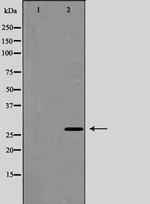 Aquaporin 5 Antibody in Western Blot (WB)