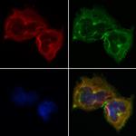 SERPINB2 Antibody in Immunocytochemistry (ICC/IF)