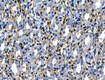 SERPINB2 Antibody in Immunohistochemistry (Paraffin) (IHC (P))