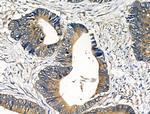 PDGF-A Antibody in Immunohistochemistry (Paraffin) (IHC (P))