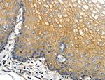 Cathepsin E Antibody in Immunohistochemistry (Paraffin) (IHC (P))