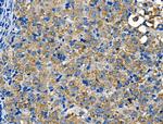 Cathepsin E Antibody in Immunohistochemistry (Paraffin) (IHC (P))