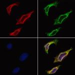 Cathepsin E Antibody in Immunocytochemistry (ICC/IF)