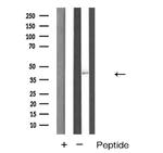 Cathepsin E Antibody in Western Blot (WB)