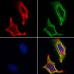 ITGA3 Antibody in Immunocytochemistry (ICC/IF)