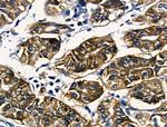 RUNX3 Antibody in Immunohistochemistry (Paraffin) (IHC (P))