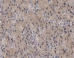 IL-11 Antibody in Immunohistochemistry (Paraffin) (IHC (P))