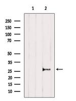 IL-11 Antibody in Western Blot (WB)