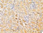 IL-11 Antibody in Immunohistochemistry (Paraffin) (IHC (P))