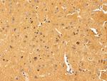 IL-11 Antibody in Immunohistochemistry (Paraffin) (IHC (P))