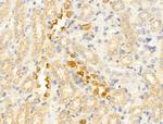 IL-11 Antibody in Immunohistochemistry (Paraffin) (IHC (P))