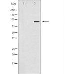 SOX6 Antibody in Western Blot (WB)