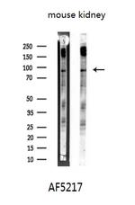 SOX6 Antibody in Western Blot (WB)