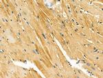 alpha Actinin 2/3 Antibody in Immunohistochemistry (Paraffin) (IHC (P))