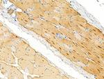 alpha Actinin 2/3 Antibody in Immunohistochemistry (Paraffin) (IHC (P))