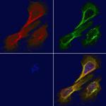 alpha Actinin 2/3 Antibody in Immunocytochemistry (ICC/IF)