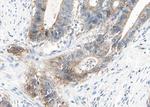 alpha Actinin 2/3 Antibody in Immunohistochemistry (Paraffin) (IHC (P))