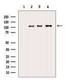 alpha Actinin 2/3 Antibody in Western Blot (WB)