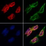 Bub3 Antibody in Immunocytochemistry (ICC/IF)