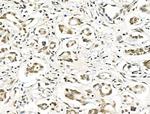 hnRNP C1/C2 Antibody in Immunohistochemistry (Paraffin) (IHC (P))