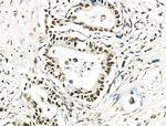 hnRNP C1/C2 Antibody in Immunohistochemistry (Paraffin) (IHC (P))