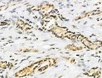 hnRNP C1/C2 Antibody in Immunohistochemistry (Paraffin) (IHC (P))