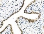 hnRNP C1/C2 Antibody in Immunohistochemistry (Paraffin) (IHC (P))