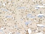 hnRNP C1/C2 Antibody in Immunohistochemistry (Paraffin) (IHC (P))