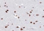 hnRNP C1/C2 Antibody in Immunohistochemistry (Paraffin) (IHC (P))