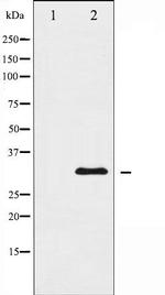 hnRNP C1/C2 Antibody in Western Blot (WB)