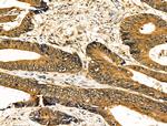 Caspase 8 (Cleaved Asp384) Antibody in Immunohistochemistry (Paraffin) (IHC (P))