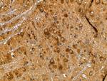 Caspase 8 (Cleaved Asp384) Antibody in Immunohistochemistry (Paraffin) (IHC (P))