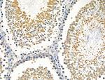 Caspase 8 (Cleaved Asp384) Antibody in Immunohistochemistry (Paraffin) (IHC (P))